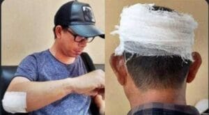 Polres Kukar Tingkatkan Kasus Dugaan Penganiayaan Kades Muara Muntai Ilir ke Penyidikan